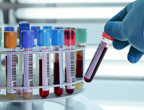 Itupeva amplia coleta de exames laboratoriais com novo ponto de atendimento