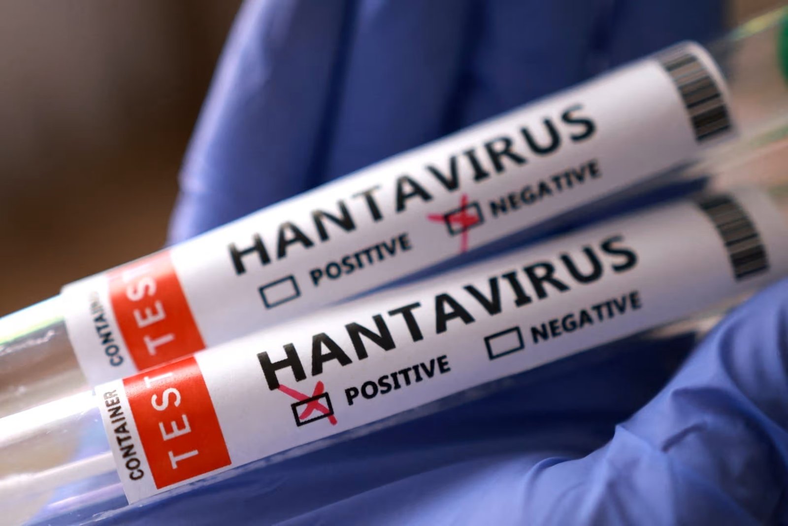 hantavirus-222557